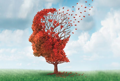 Y a-t-il un lien entre la perte auditive et l’Alzheimer ?